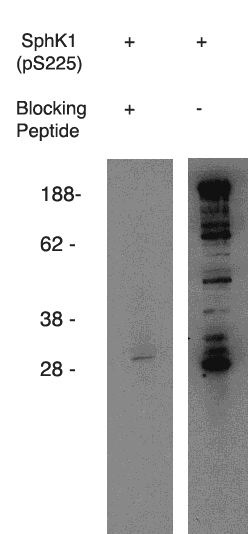 Western blot using anti-mouse SphK1 (pS225) (Cat. No. X1849P) on mouse B-cell lysate.  Antibody used at 1 µg/ml with phosphorylated blocking peptide (Cat. No. X1877B) (lane A) and without (laneB).